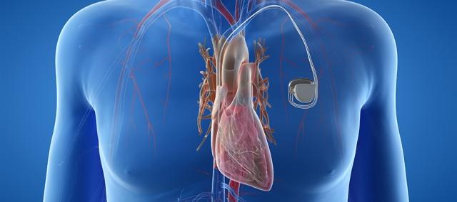 Cardiac Restoration Systems Market Size, Trends & Growth Analysis 2025-2032